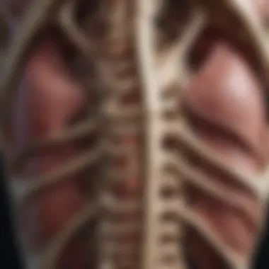 Anatomy of Rib Bones with Bone Cancer Anatomical depiction of rib bones affected by cancer