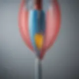 A detailed view of a cutting balloon catheter showcasing its innovative design.