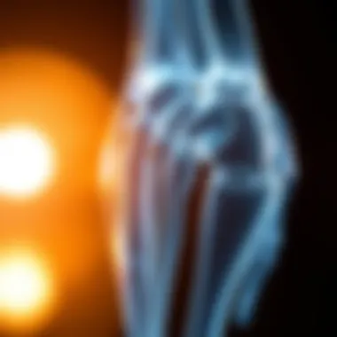 Emerging Research: Prolia's Role in RA Management Emerging research highlights on Prolia's role in rheumatoid arthritis management