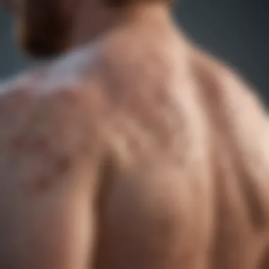 Research Findings on Psoriasis and Lung Cancer Link Research findings on psoriasis and lung cancer link