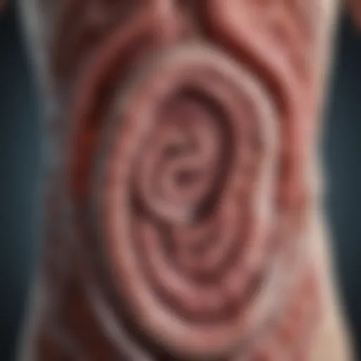 Illustration depicting the gastrointestinal tract affected by colitis