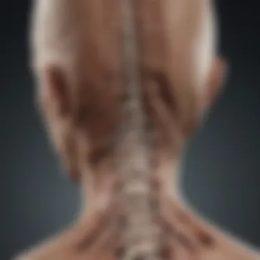 Treatment Options for Traumatic Spinal Stenosis Chart illustrating treatment options for traumatic spinal stenosis