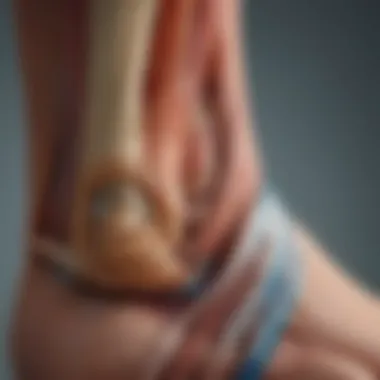 Anatomy of the Achilles Tendon Illustration of the Achilles tendon anatomy highlighting key areas