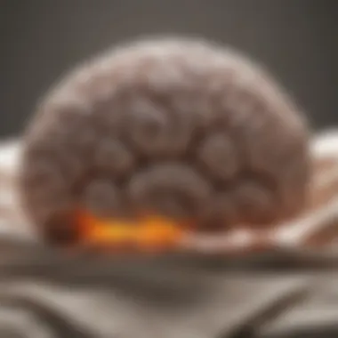 Brain Activity in Narcolepsy Illustration of brain activity during sleep attacks