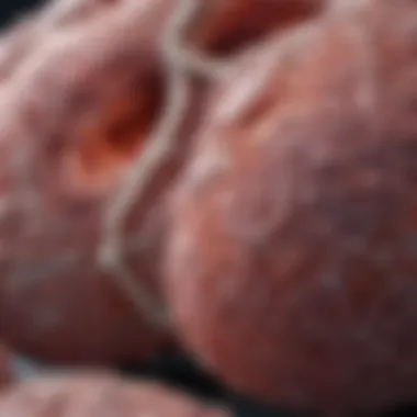 Analysis of Large Cell Lung Cancer Tumor Sample Large cell lung cancer tumor sample analysis