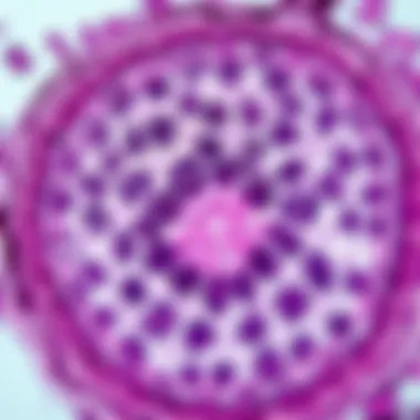Leiomyosarcoma tissue sample