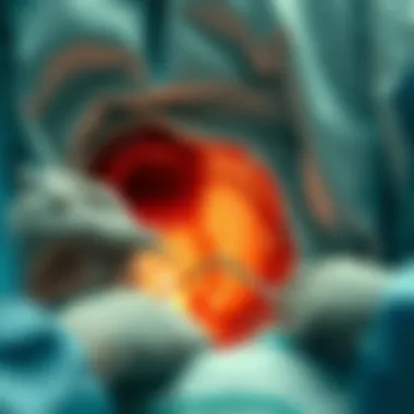 Overview of the Nephrostolithotomy Procedure A visual representation of the nephrostolithotomy procedure