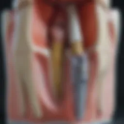 Illustration of root canal anatomy