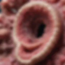 An illustration depicting the growth of colon polyps within the intestinal lining.