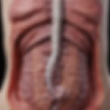 Understanding the Connection between Ulcerative Colitis and Osteoporosis Diagram illustrating the connection between ulcerative colitis and osteoporosis