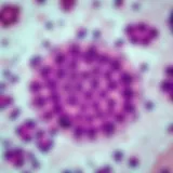 Histopathological slide of giant cell granuloma showing multinucleated giant cells