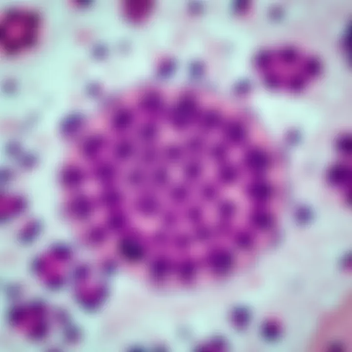 Histopathological Insight into Giant Cell Granuloma Histopathological slide of giant cell granuloma showing multinucleated giant cells