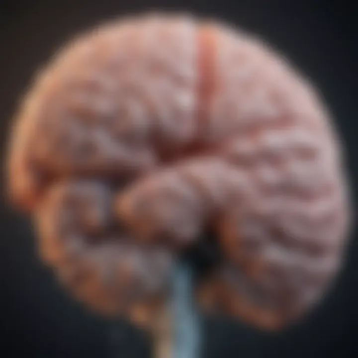 Illustration showing the brain regions involved in hallucinations related to Parkinson's disease